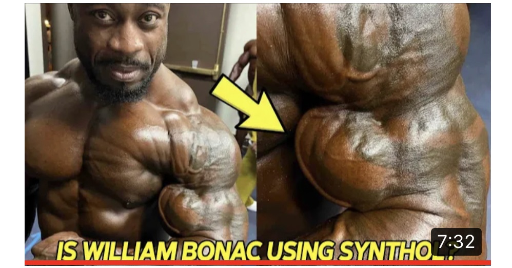Ivan Bodybuilding’s William Bonac Synthol Video